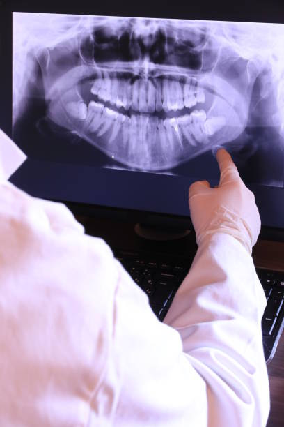 Best Emergency Dental Care for Broken or Chipped Teeth in Canal Fulton, OH