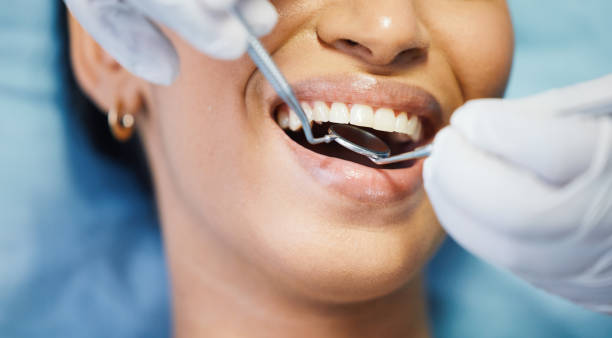 Best Emergency Tooth Extraction in Canal Fulton, OH